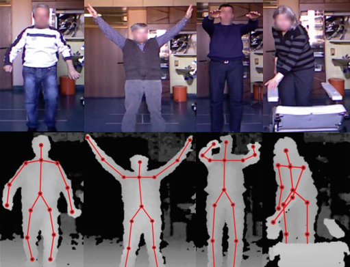 Gait and upper-body movement analysis using vision-based sensor in Parkinson's disease